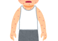 【ご高齢者は特に注意】帯状疱疹は“早めの対応”が安心につながります